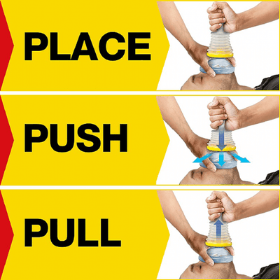 Anti-Choking Device Travel Kit - Portable First Aid Airway Clearance